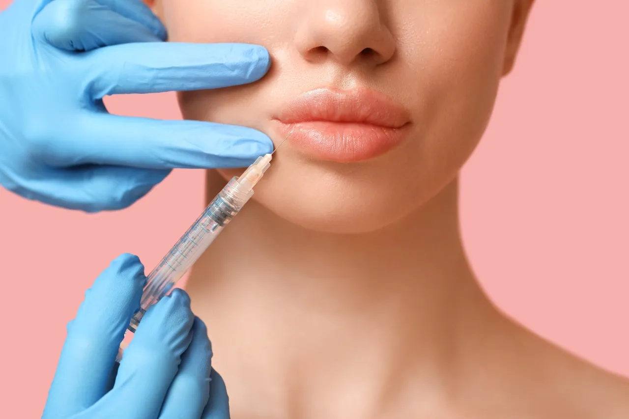 TECHNIKI WYPEŁNIANIA – PREPARATY NA BAZIE USIECIOWANEGO KWASU HIALURONOWEGO
