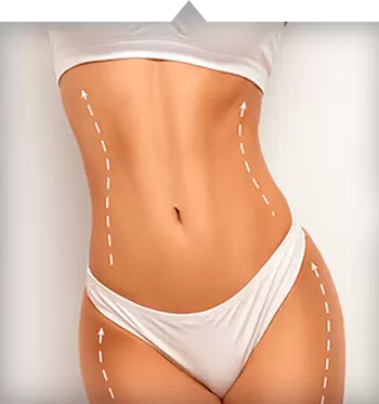 Cellulit i tkanka tłuszczowa